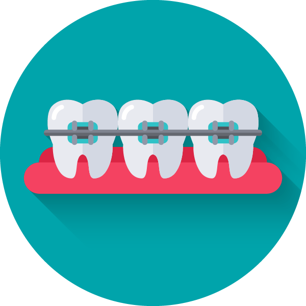 歯並び矯正のイメージ