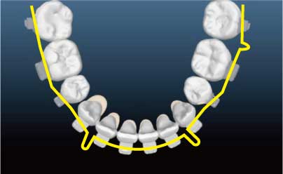インシグニアのイメージ1