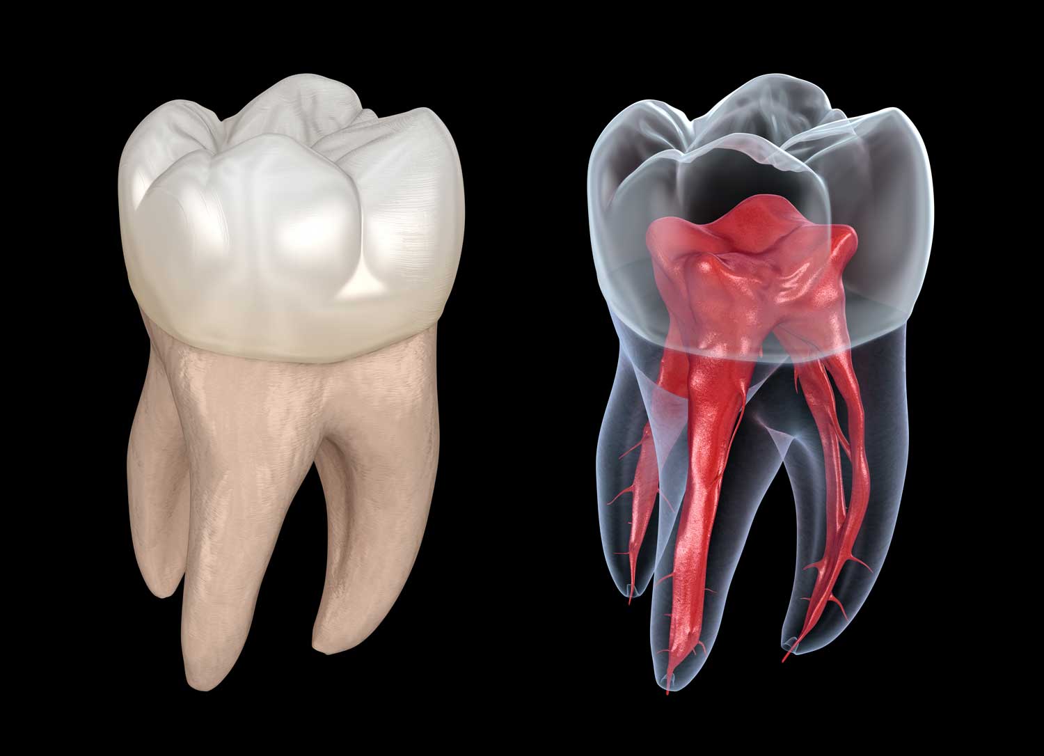 歯の内部構造イメージ